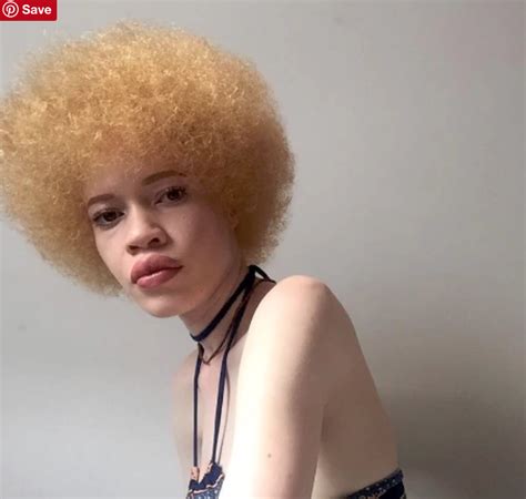 albino black porn|'AFRICAN albino' Search .